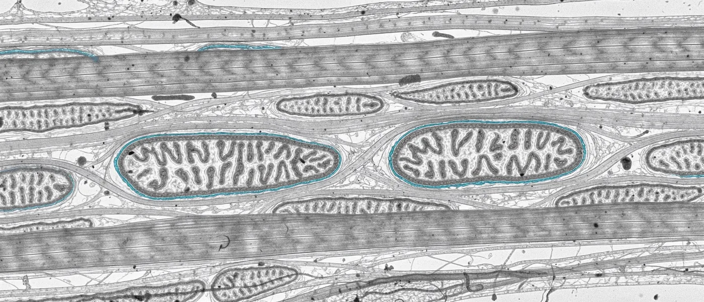 Microscopy-style view of mitochondria with folded inner membranes among muscle fibers